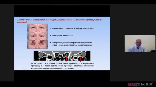 4. Приобретенные несодружественные формы косоглазия: диагностика и хирургическое лечение