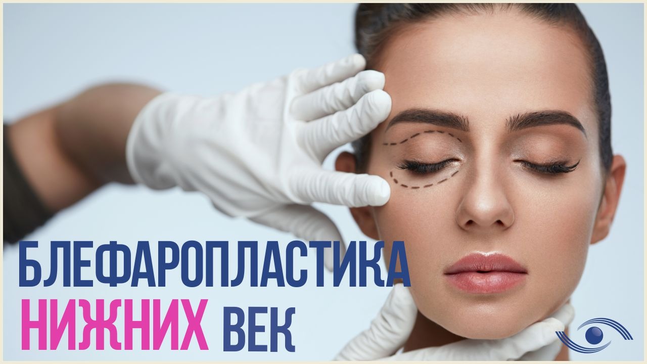 В чем заключается блефаропластика нижних век? / Нижняя блефаропластика