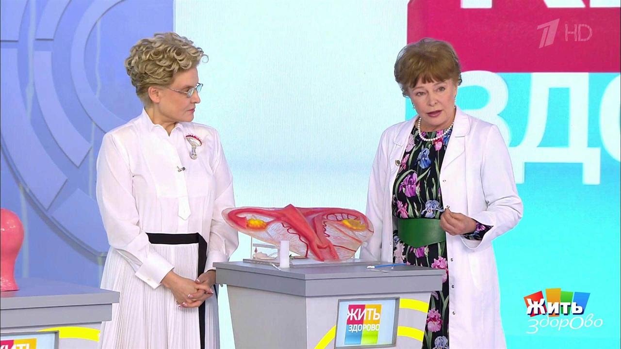 Лечить или не лечить? Вирус папилломы человека. Жить здорово! Фрагмент выпуска от 05.12.2019
