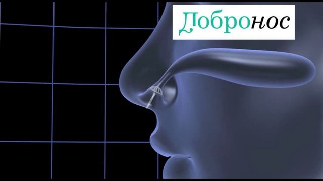 Принцип действия фильтров для носа - Добронос Комфорт от пыли и аллергенов смотреть онлайн