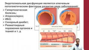Эндотелиальная дисфункция.  Агранат Филипп Дмитриевич
