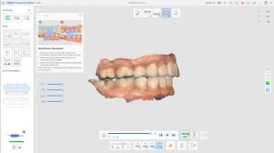 How to transfer the dynamic occlusion to exocad