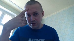 ШЕЛУШИТСЯ КОЖА ВЫПАДАЮТ ВОЛОСЫ РЕШЕНИЕ ПРОБЛЕМЫ