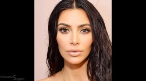 KIM KARDASHIAN: Before and After Plastic Surgery