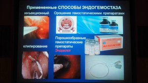 49Мечёва ЛВ Колоноскопия при кровотечениях и пациентов отделений реанимации и интенсивной терапии