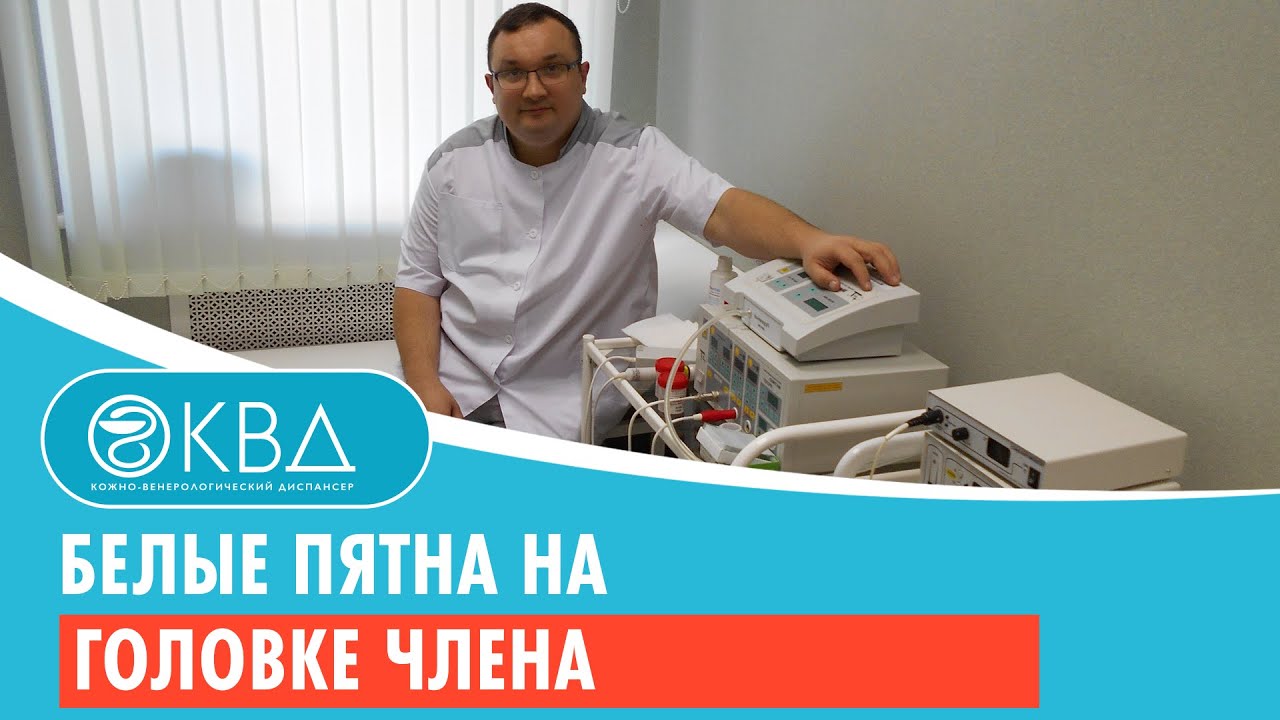 Белые пятна на головке члена. Клинический случай №42