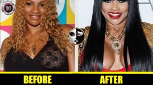 Sandra Denton Plastic Surgery Before and After - ( Botched Nose Job | Breast Implants | Butt Shots