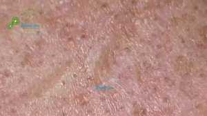 Make Your Day Relaxing with Windy Spa 6#196