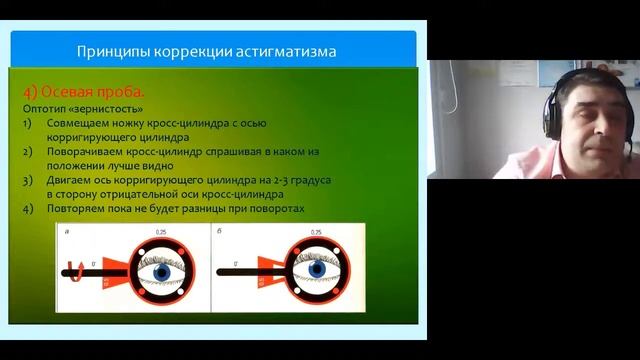 Астигматизм вебинар Часть 4. Диагностика и принципы коррекции астигматизма.