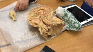 Анатомия. Полость носа и Гортань (Ч1).