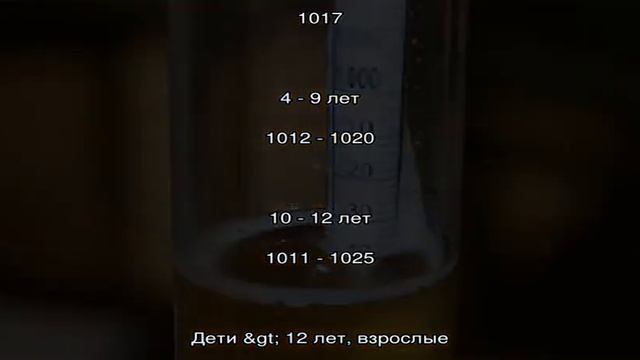 Показатель SG в анализе мочи смотреть онлайн