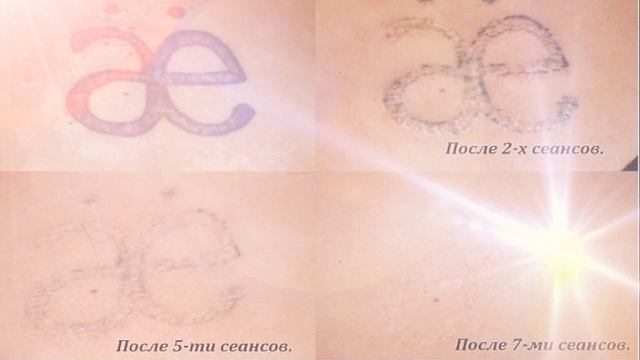 ТАТУИРОВКА НАТАЛЬЕ МИКРОБЛЕЙДИНГ