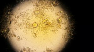 ЖИР в кале !