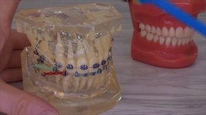 Монопучковая зубная щётка