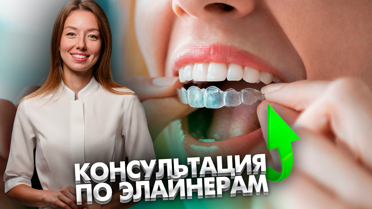 Консультация стоматолога-ортодонта по планированию лечения на элайнерах. Стоматология. Стоматолог.
