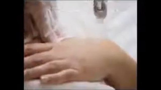Использование MED Jet в Клинике Молодости и Красоты. тел.8(928)626 52 62, 8(928)279 42 56