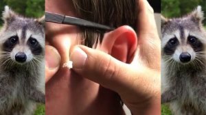 Мерзкое видео  ? | чёрные точки в ушах. У тебя тоже есть такие ! ???Blackheads extraction