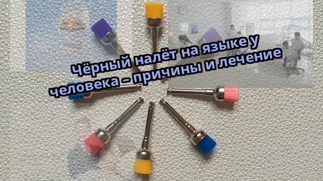 Чёрный налёт на языке у человека – причины и лечение смотреть онлайн