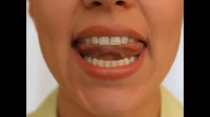 Занятия с логопедом - упражнение "Дятел"