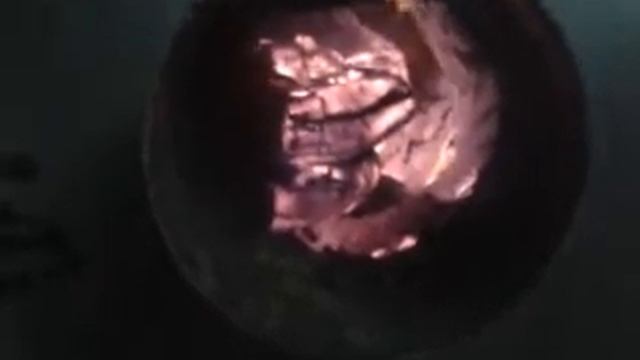 гайморит - избавляемся раз и навсегда. смотреть онлайн