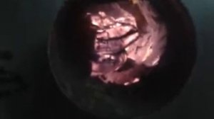 гайморит - избавляемся раз и навсегда.