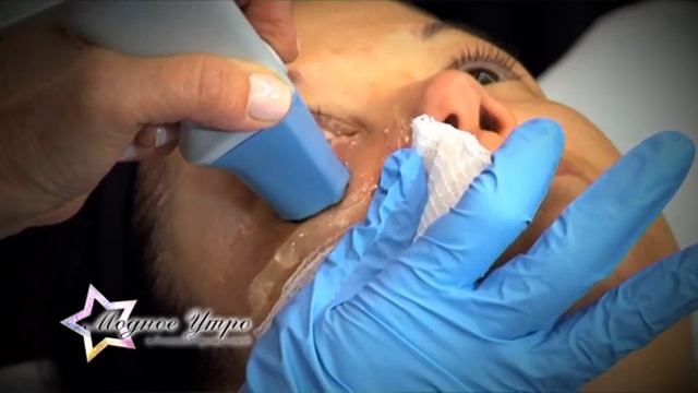 Эстонское телевидение о RF системе Exilis Elite от BTL смотреть онлайн