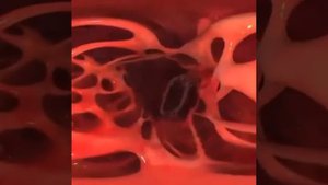 Сердца:двустворчатый (митральный клапан) и аортальный