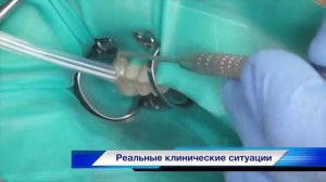 Коффердам  Методика применения  Анонс семинара