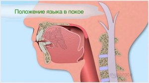 Как сделать зубы ровными. Система Myobrace