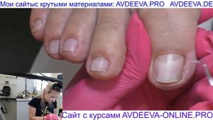 ПЕДИКЮР ОНЛАЙН. СЛОЖНАЯ СТОПА. Виктория Авдеева