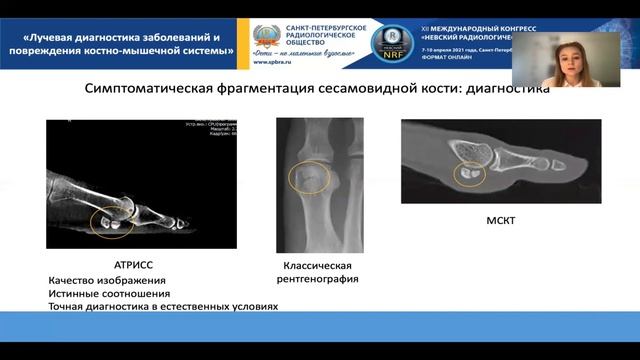 Научная секция «Лучевая диагностика заболеваний и повреждения костно-мышечной системы»