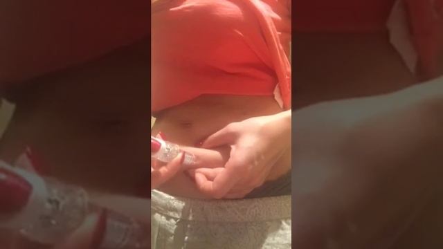 Укол Клексаном смотреть онлайн