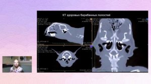 Прямая трансляция пользователя oks_listova