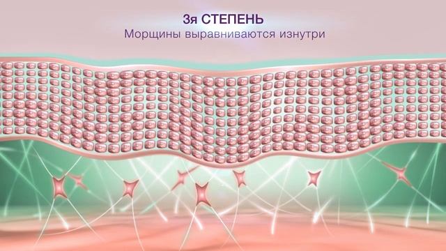 HYALURIDES LP - ИННОВАЦИЯ ПРОТИВ МОРЩИН 2017 смотреть онлайн