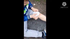 Падение на самокате.Последствия