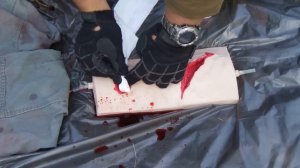 ТАМПОНИРОВАНИЕ РАНЫ