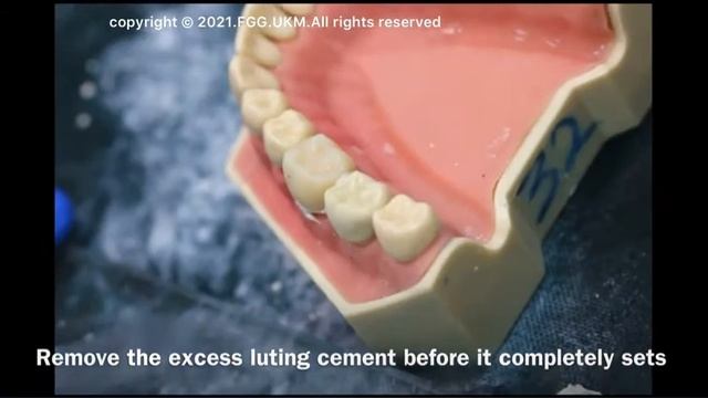 Mixing Polycarboxylate POLY F Cement смотреть онлайн