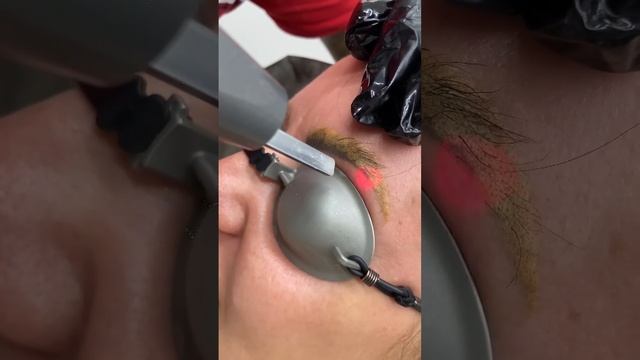 ASMR - Удаление татуажа бровей  ✅ #tattoo #удалениетату | студия  "Битый Небитого" САНКТ-ПЕТЕРБУРГ