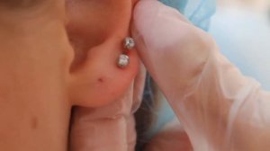 Прокол ушей Стадекс 75