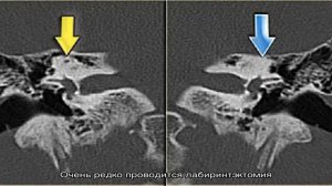 Болезни внутреннего уха и их симптомы