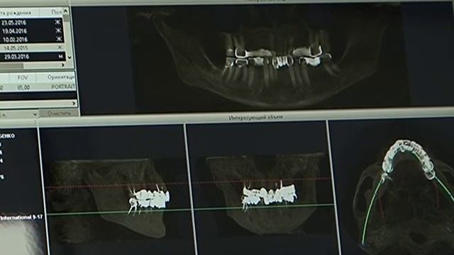 Открытие отделения в Стоматполиклинике № 1 смотреть онлайн