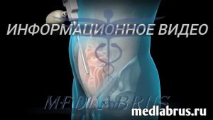 Паховая грыжа