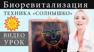 Техника биоревитализации "Солнышко"