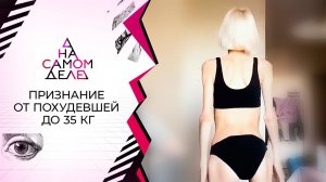 Шокирующая история истощенной до 35 килограммов. На самом деле. Выпуск от 24.05.2021