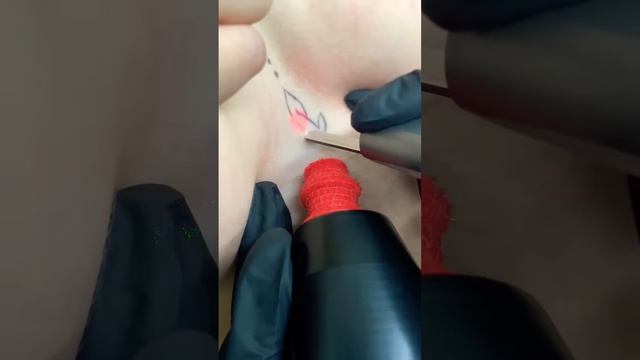 Удаление между груди татуировки  ✅ #tattoo #удалениетату | студия  "Битый Небитого" САНКТ-ПЕТЕРБУРГ