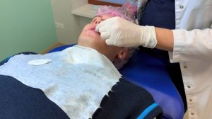 СДЕЛАЛ ГУБЫ СВОЕЙ МЕЧТЫ и вот что получилось..