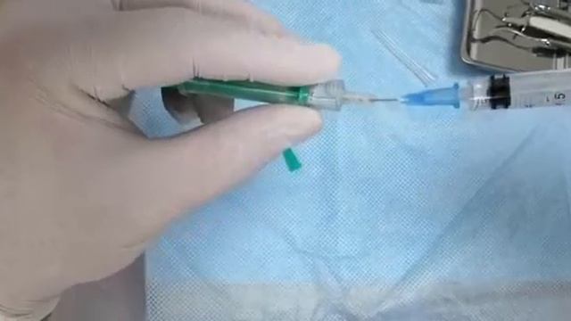 Использование "Сульфакрилата" в стоматологии смотреть онлайн