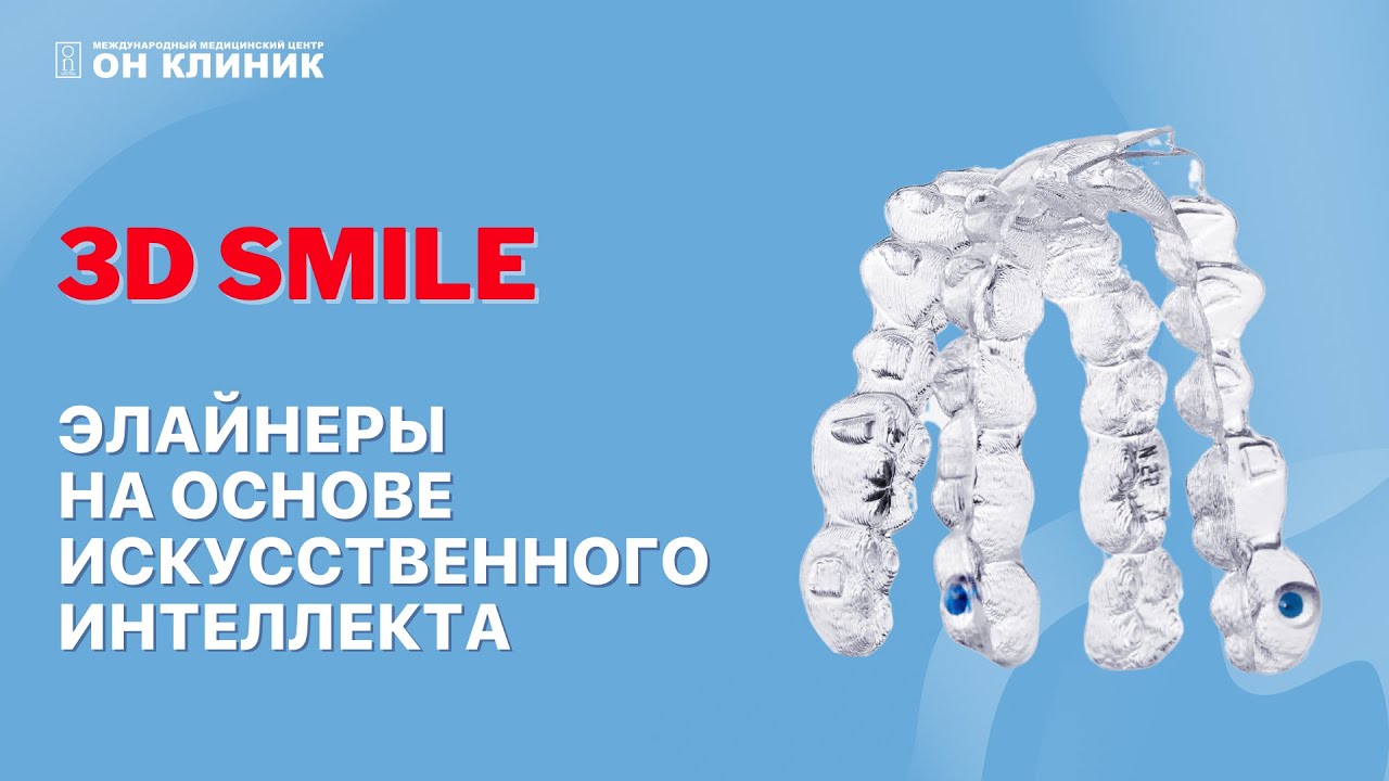 Красивая улыбка без брекетов! Элайнеры для зубов 3D Smile.