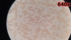 Кровь после газированной воды