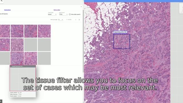 SMILY : Similar image search for pathologists смотреть онлайн